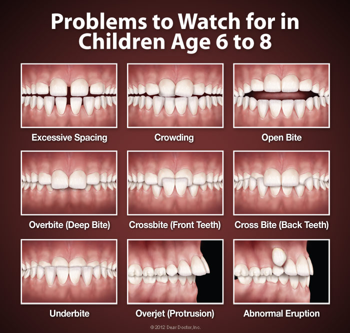Orthodontic Concerns